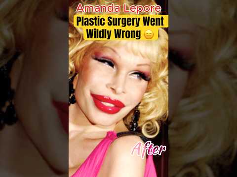 Plastic surgery went wrong #hollywood #shorts