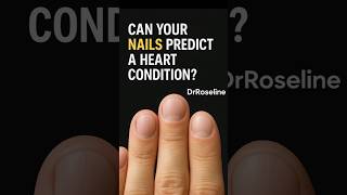 What your nails say about your heart.   #HeartHealth #MedicalSigns #doctorexplains #YouTubeShorts