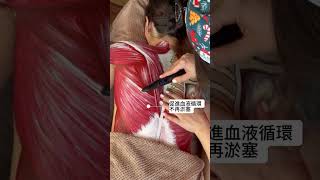 🌟【Achedaway即熱式筋膜刀】親身體驗：肌肉即刻鬆晒！🌟