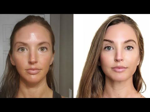 The Shape Of Her Face Transformed