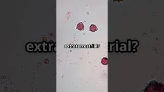 Red Rain in India? 🧫 | Alien Cells or Natural Mystery?