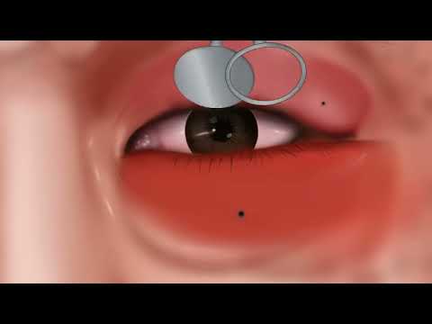 ASMR Animation: Ma Dong Soek’s Intense Battle Against Painful Bee Stings!#ASMR #Animation #BeeSting