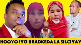 CADEYMO CUSUB: KIIS AXLAAM HOYADI UBADKA LAGA DHIBATEYAY OO WAJI CUSUB YEESHAY
