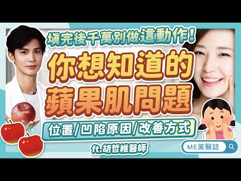 蘋果肌位置到底怎麼看？老了蘋果肌一定會凹陷？醫師建議的填補材質！ft.胡哲維醫師【ME美醫誌】