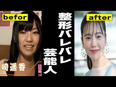 【有益2ch】整形バレバレ芸能人【ガルちゃん芸能人】