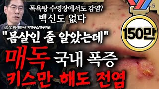 [슬라생] "몸살인 줄 알았는데..." 키스만 해도 전염, 국내 폭증한 감염병.... 백신도 없다 #매독 #성병 #전염병 _250304