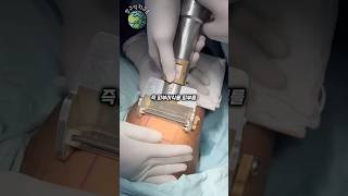 일반인이 보면 기겁할 의료기기