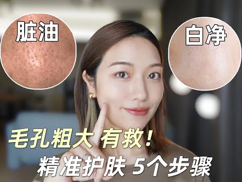 温和不烂脸，快速改善毛孔粗大！干净如磨皮