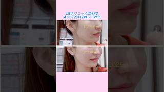 オリジオX 30代 ビフォアフ 600ショット＋口元+眉