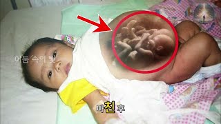 태어나자마자 임신한 신생아 ! 병원 전체가 충격에 빠진 이유!