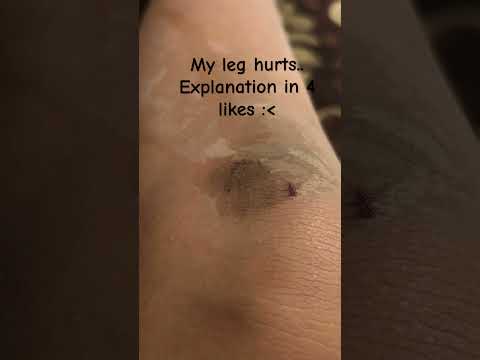 It hurts like a knife hitting me