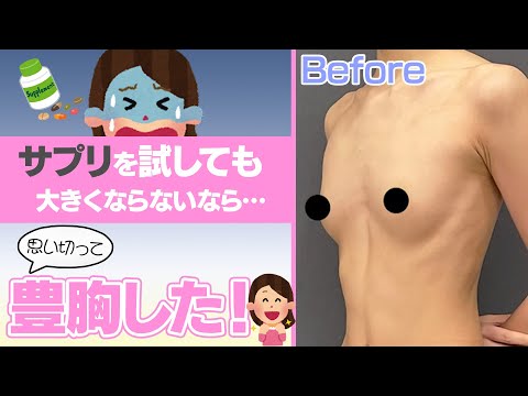 サプリを飲んでも大きくならい…思い切って！豊胸でサイズアップ！！【シリコンバッグ豊胸密着】