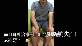 粉碎性骨折後，脊髓神經壓迫、肛門 尾椎痛3年- 乾針後竟然痊癒！Cure Neuralgia, Spinal Cord Injury by Dry needling, Auricular acu