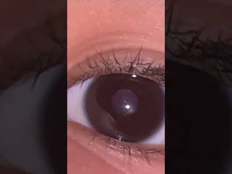 eye reavel ig