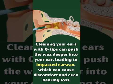 Can you use Q-Tips to clear Ear wax?