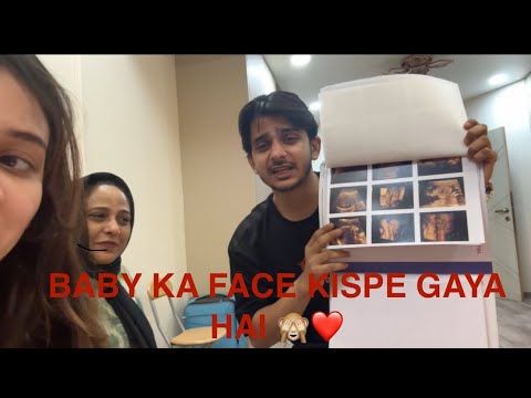 BABY KA FACE KISPE GAYA HAI🙈😍🫢  [4D/5D SONOGRAPHY] REPORT