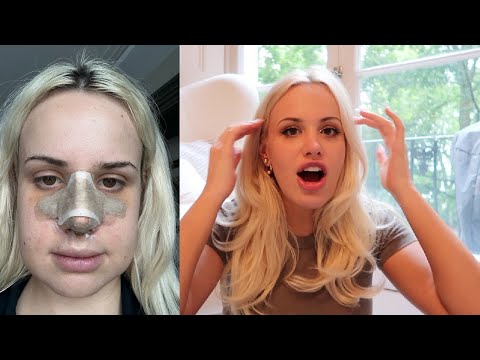 one year after my "BOTCHED" nose job