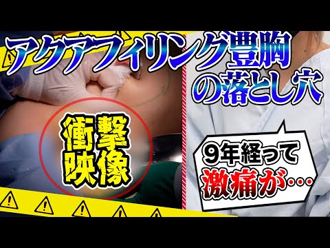 アクアフィリングが胸を溶かす！豊胸後9年後に激痛が…