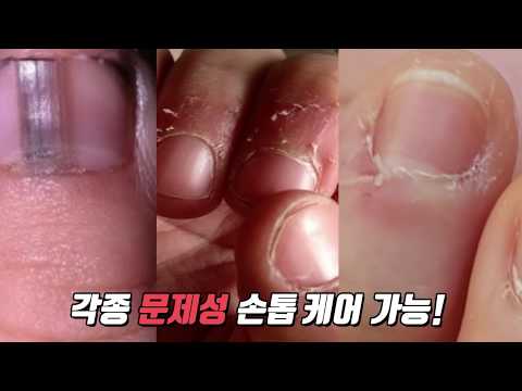 손톱 예쁘게 기르는 방법 손톱보호제로 관리!