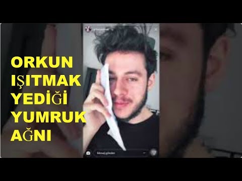 ORKUN IŞITMAK ÇEKİM SIRASINDA İNANILMAZ ŞEKİLDE YUMRUĞA MARUZ KALDI!!!!!