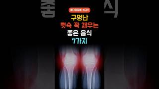 구멍난 뼛속 꽉 채우는 음식 7가지🦴 - 골다공증에 좋은 음식 7가지