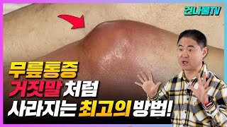50대 이상 무릎통증, 관절염 사라지는 최고의 방법! (관절염에 좋은 음식들)