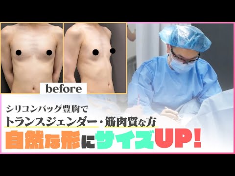 確実なサイズアップなら！シリコンバッグ豊胸！！