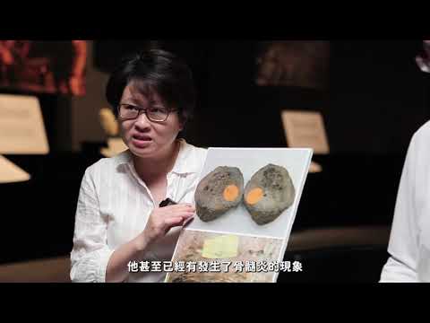 打斷手骨顛倒勇!?斷過的骨頭長得特別粗? 要如何預防骨折?【人骨診療室3 】