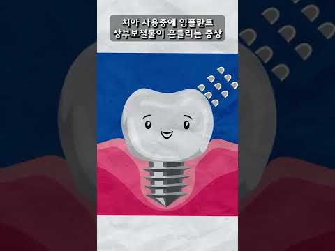 임플란트 보철 후 주의사항?