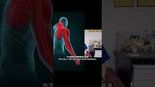 直播預告:你有手麻痺嗎？可能是頸椎根病變！現場運動示範及Wednesday, November 20, 2024 at 8pm (HK time GMT+8)