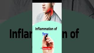 Common Diseases | Names, Symptoms & Medical Stands