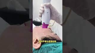 泰国热玛吉/凤凰电波价格超香！！ #泰国医美 #推薦 #泰国曼谷 #熱門 #泰国