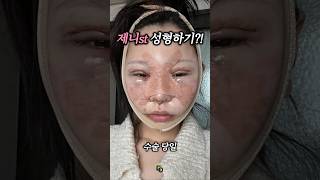 "제니st 성형" 가능한거였음?! 🎀 #jennie