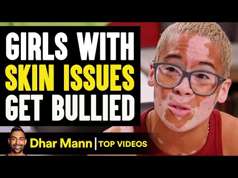 Girls With Skin Issues Get Bullied | Dhar Mann