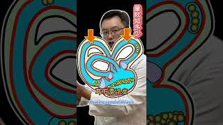 耳神雙專Dr 陳建志｜耳石復位術會一次成功嗎？不可能！ #眩暈 #暈眩 #治療失敗 #醫療糾紛 #耳石復位術 #科普