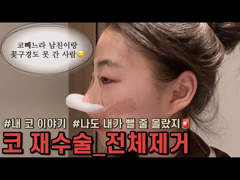 [코수술 현실vlog] Ep.2 성형부작용으로 결국 다 빼고 왔습니다…🤚🏻 병원 고르는 꿀팁부터 수술당일, 다음날까지의 회복 과정 브이로그👃🏻