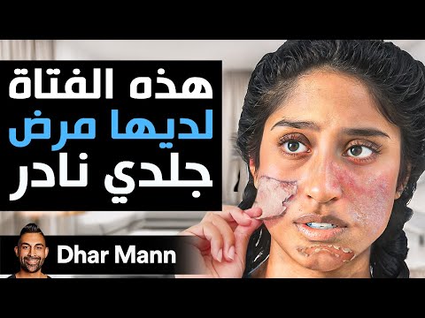 Dhar Mann Studios | هذه الفتاة لديها مرض جلدي