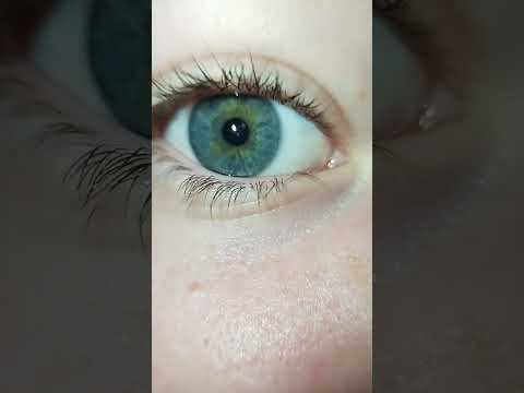 So many tries... and now I'm blind