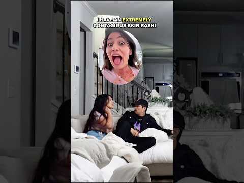CONTAGIOUS SKIN RASH PRANK ON FAMILY!! *HILARIOUS* 🤣🤣