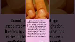 The Quincke Sign #pulse #medicalsigns #health #medicine #education #youtube   #knowledge #shorts
