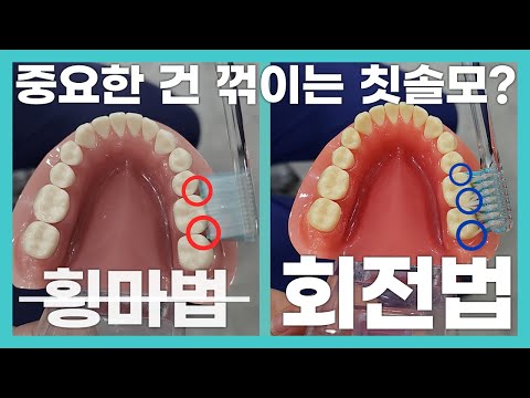 [TBI] 치아 사이사이를 제대로 닦으려면 회전법!