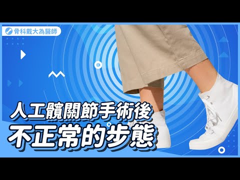 人工髖關節手術後為什麼走路還是怪怪的? 難道是是長短腳? 髖關節手術後3個常見的不正常步態