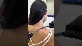 如何用筋膜刀松解肩膀#massage #按摩 #shorts