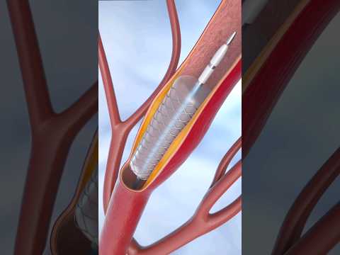 Blocking#health #shortvideo #tecknology #animation #animationvideo