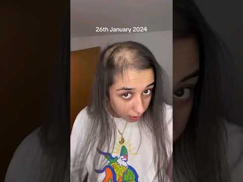 Hairfall #shortvideo #health #youtubeshort #viral #viralvideo #viralshort #viralvideos #viralreels