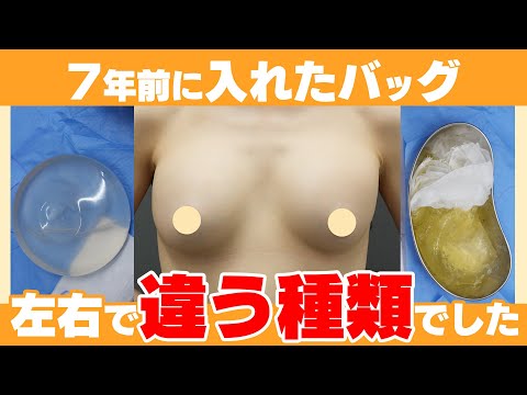 衝撃！左右で違う種類のバッグが入っていた？？破損したバッグの入れ替え！