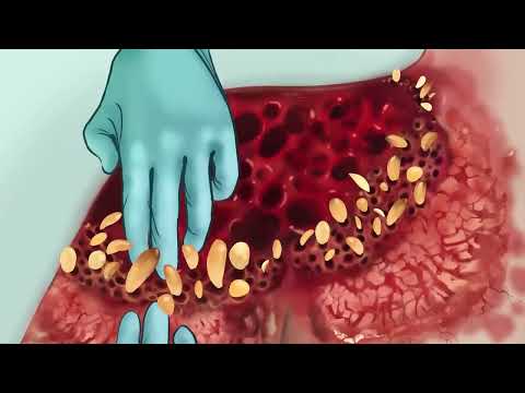 ASMR｜ASMR: Gently Removing Ticks from a Farmer’s Shoulder – Caution for Trypophobia!Tags:#ASMR#