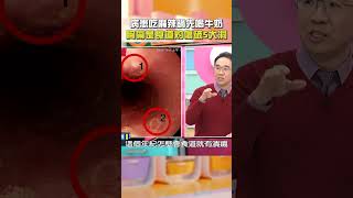 年輕病患吃#麻辣鍋 先喝#牛奶？#胸痛 竟是#食道#灼傷 破5大洞！【#醫師好辣】#shorts