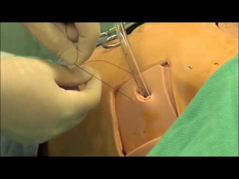 Chest Tube Video