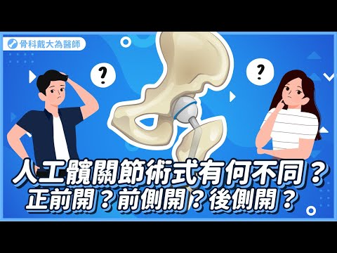 人工髖關節手術中各種術式的不同。正前開? 前側開? 後側開?